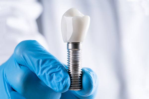 How Dental Implants Are Used With Bridges