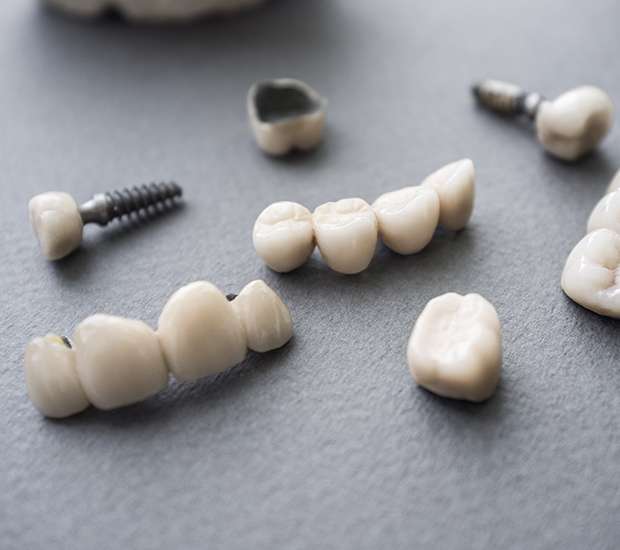 Phoenix The Difference Between Dental Implants and Mini Dental Implants