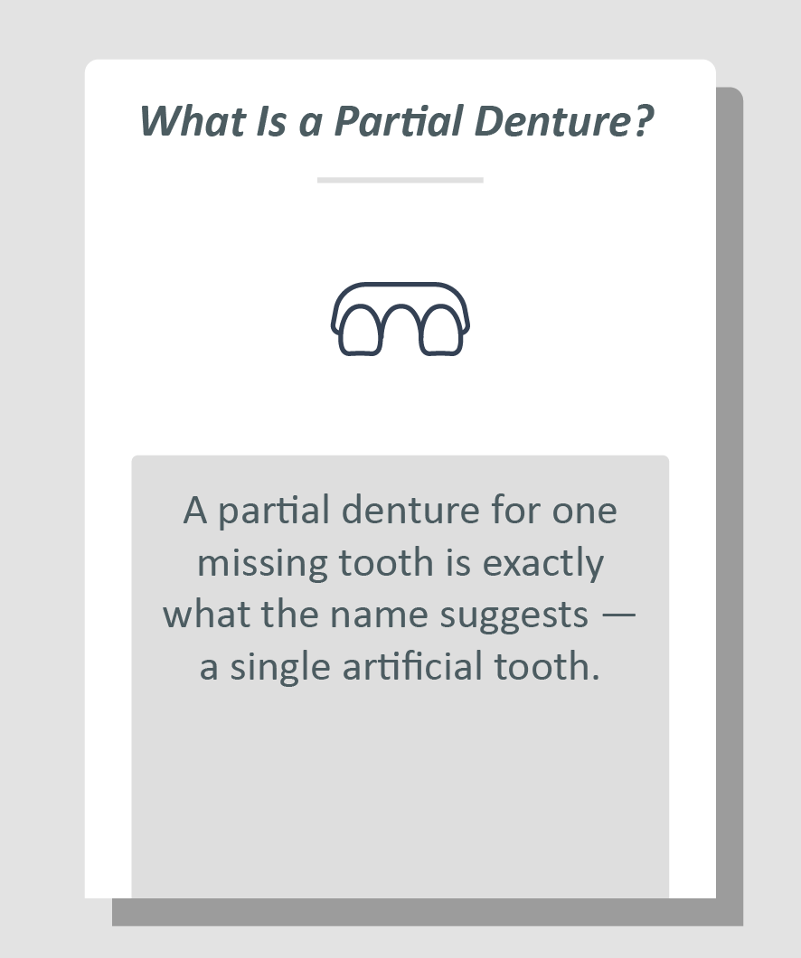 Partial denture for one missing tooth infographic: A partial denture for one missing tooth is exactly what the name suggests   a single artificial tooth.